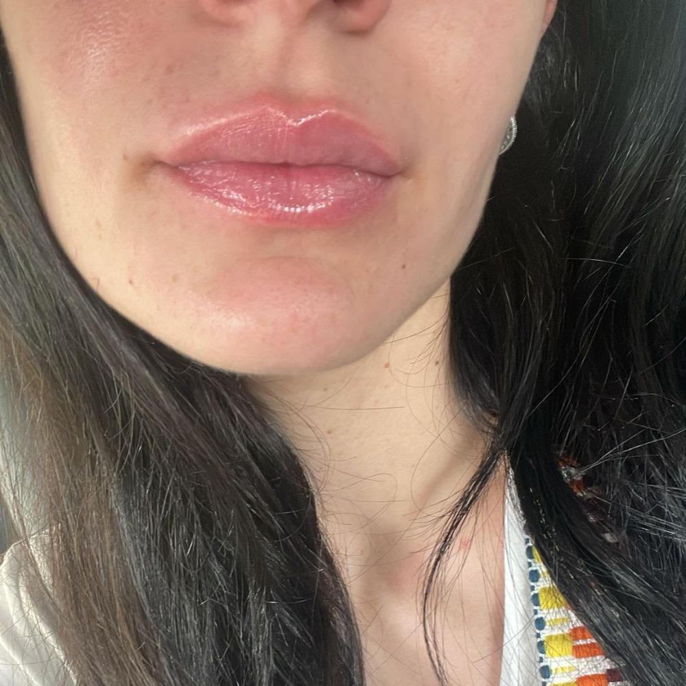 Lip Boosting Kit